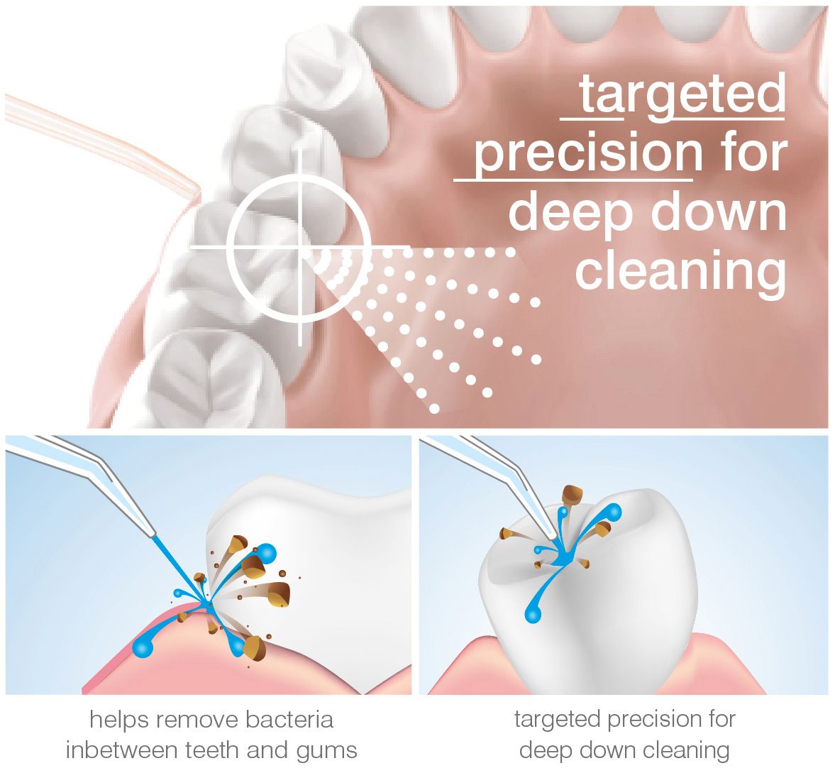 illustrations of oral irrigator in use with captions targeted precision for deep down cleaning, helps remove bacteria inbetween teeth and gums, targeted precision for deep down cleaning