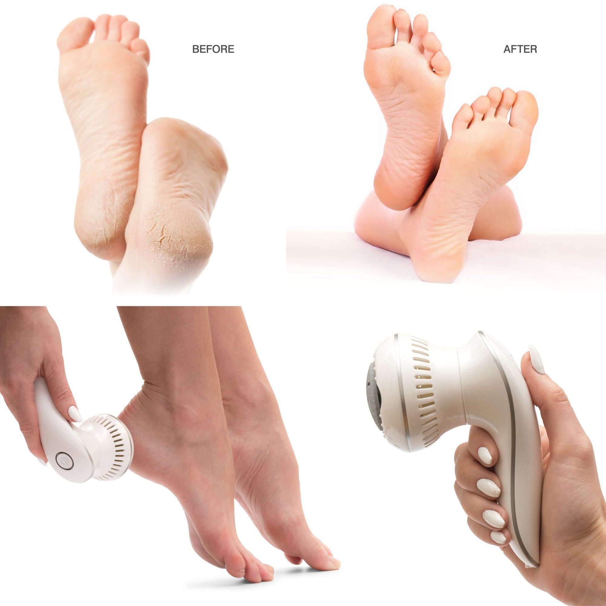 before image of dry skin cracked heels and after of smooth skin on feet alongside images of the 60 second spa pedi in use