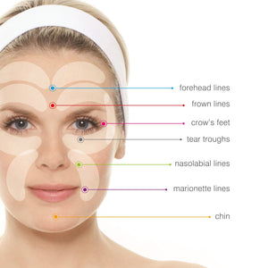blonde ladies face highlighted with areas where collagen and retinol pads can be used and colour coded arrows pointing to areas of the face which can be treated with rio lift plus 60 second face lift forehead lines frown lines crows feet tear troughs nasolabial lines marionette lines chin 