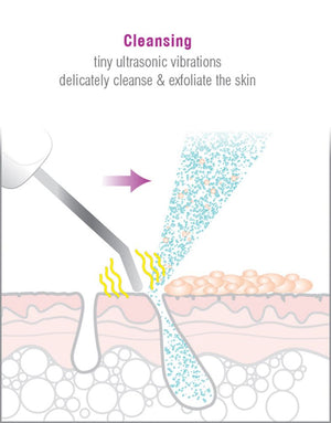 diagram illustrating how the ultrasonic vibrations from the blade placed angled against the skin delicately cleanses and exfoliates 