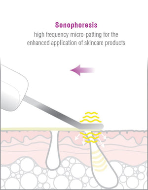 diagram illustrating how the ultrasonic vibrations from the blade pressed flat against the skin provides high frequency micro-patting for the enhanced application of skincare products 