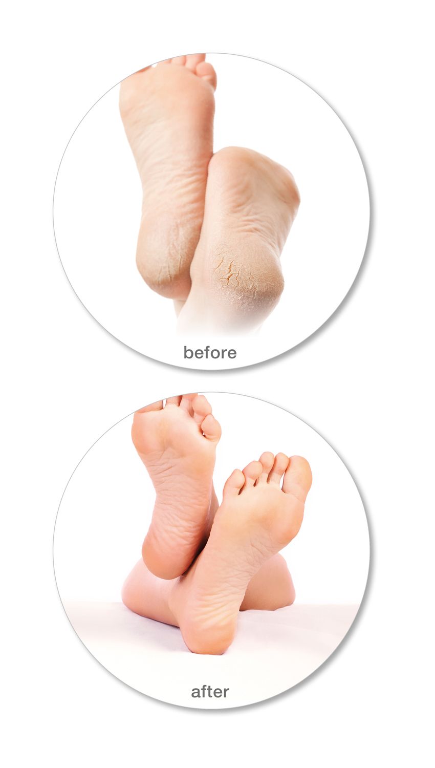 before and after of using 60 second pedi before image showing feet with dry hard skin and cracked heels, after image showing smooth fresh feet