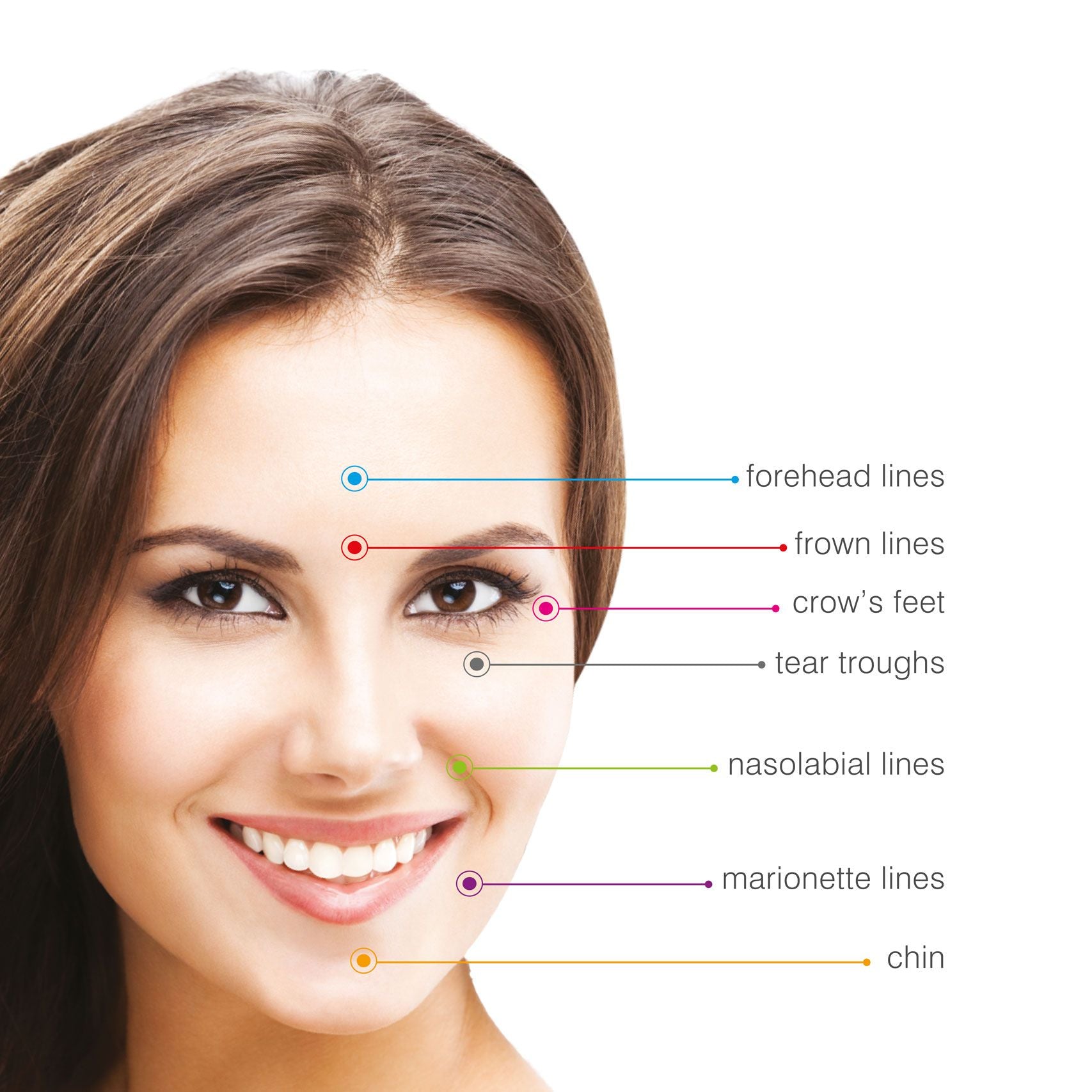 brunette smiling ladies face with colour coded arrows pointing to different areas of the face which can be treated with the Rio 60 second face lift forehead lines frown lines crows feet tear troughs nasolabial lines marionette lines chin